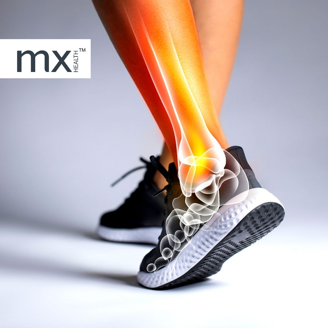 Product In use 1 MX74211 Neoprene Ankle